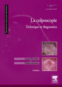 Baixar La colposcopie: Technique et diagnostics pdf, epub, ebook