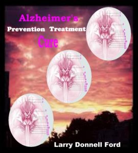 Baixar Alzheimer’s – Prevention, Treatment, Cure (English Edition) pdf, epub, ebook