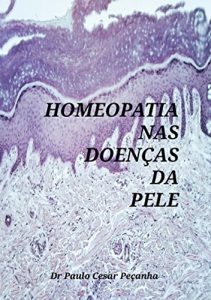 Baixar Homeopatia Nas DoenÇas Da Pele (Portuguese Edition) pdf, epub, ebook