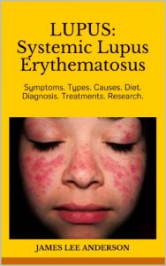 Baixar LUPUS:  Systemic Lupus Erythematosus: Symptoms. Types. Causes. Diet.  Diagnosis. Treatments. Research. (English Edition) pdf, epub, ebook
