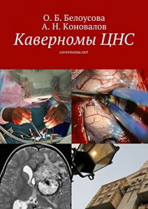 Baixar Каверномы ЦНС: cavernoma.net pdf, epub, ebook