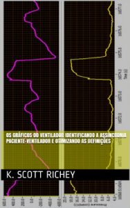 Baixar Os Gráficos do Ventilador Identificando a Assincronia Paciente-Ventilador e Otimizando as Definições (Portuguese Edition) pdf, epub, ebook